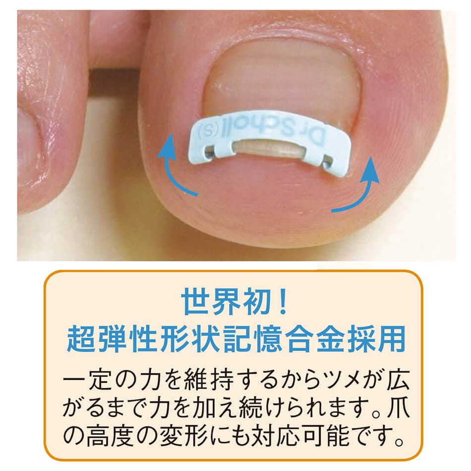 ドクターショール 巻き爪用クリップ