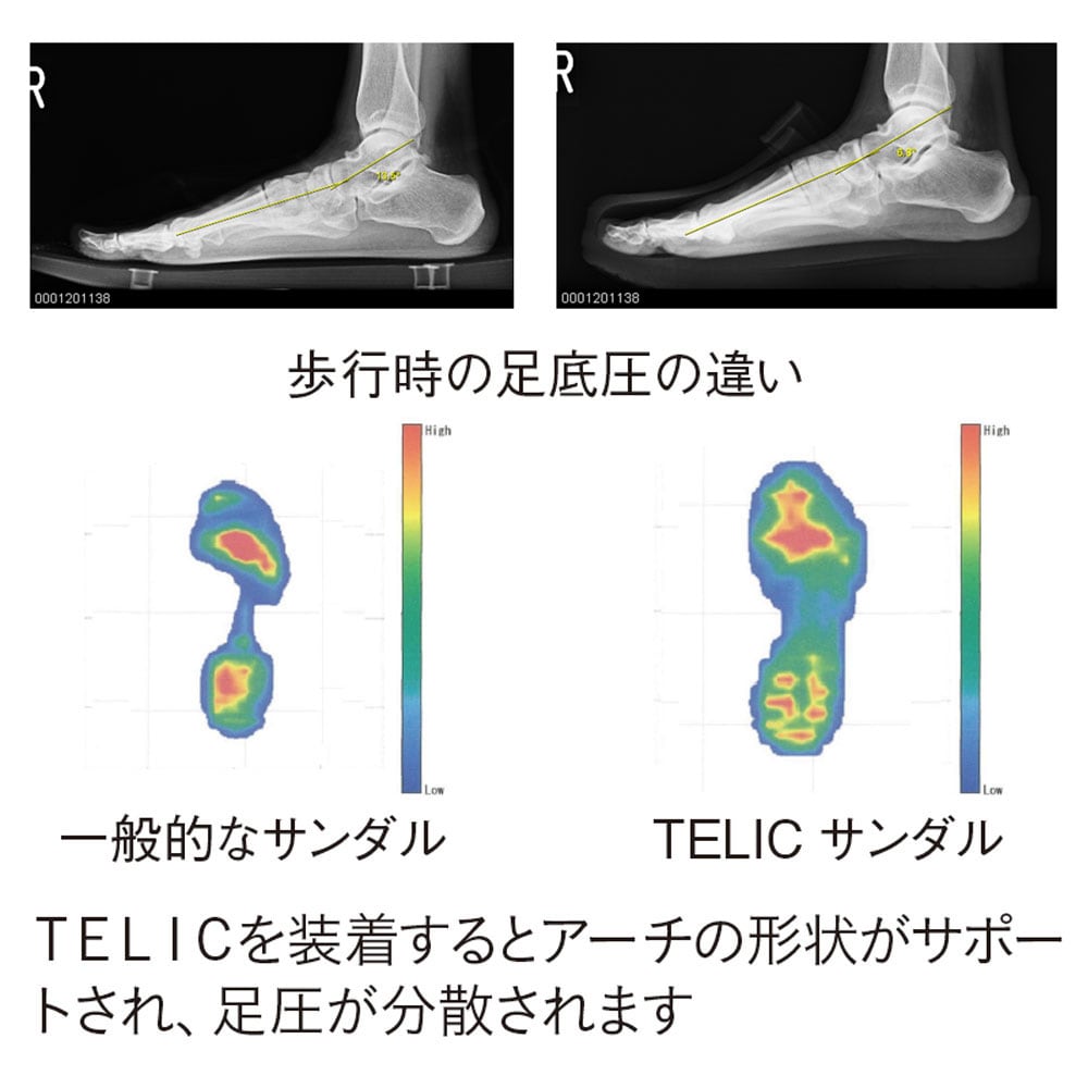TELIC リカバリーサンダル ドクターズサボ