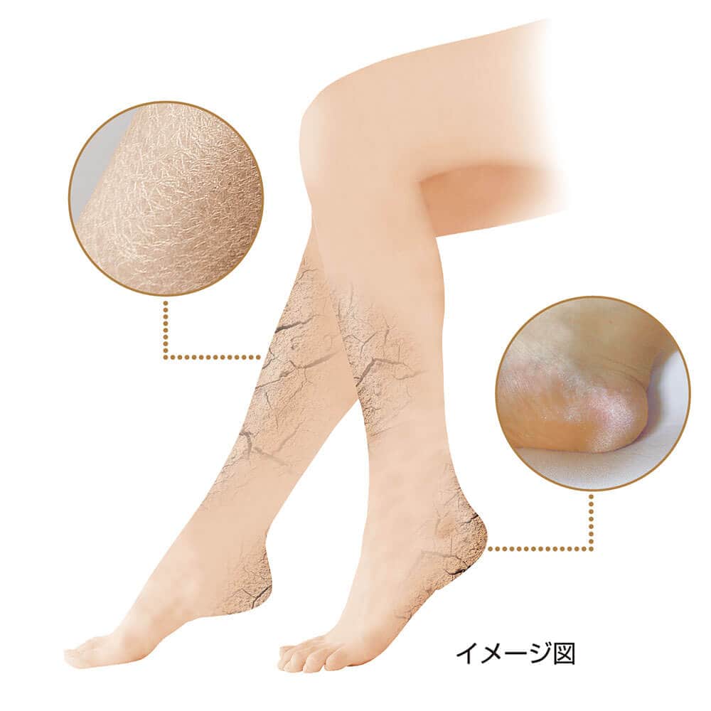 つらいガサガサ足に