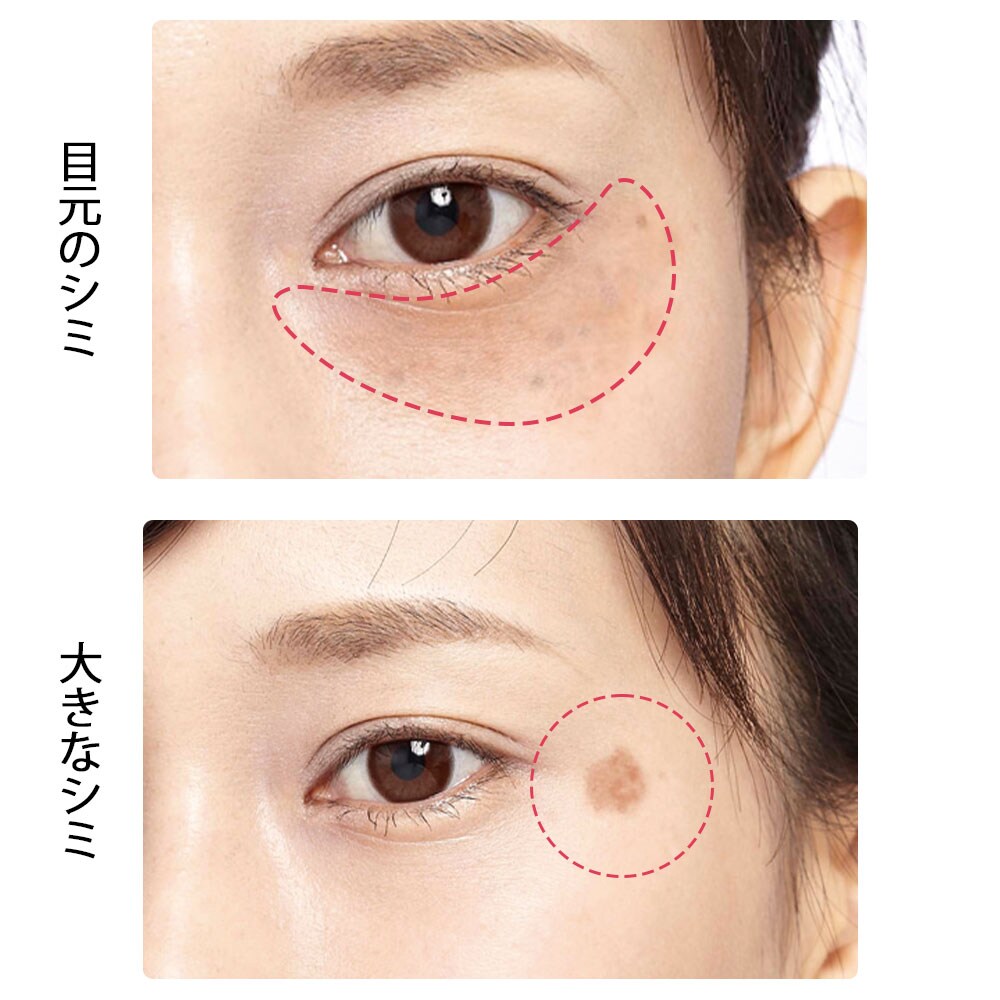 白衣や看護師 ナース用品の通販 ナースリー公式オンラインショップ 薬用シミーポロンスティック